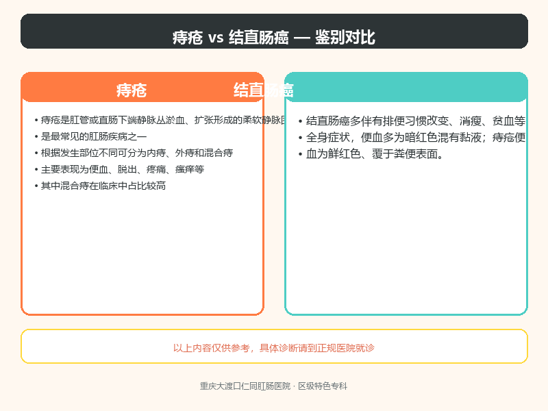 痔疮与结直肠癌的鉴别要点