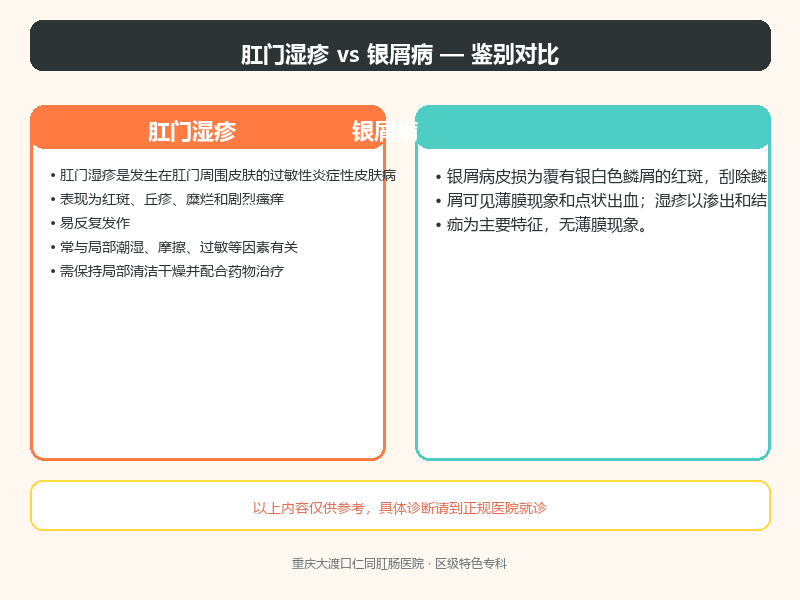 肛门湿疹与银屑病的鉴别