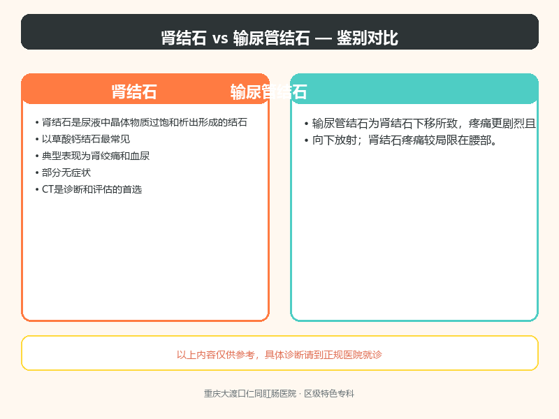 肾结石与输尿管结石
