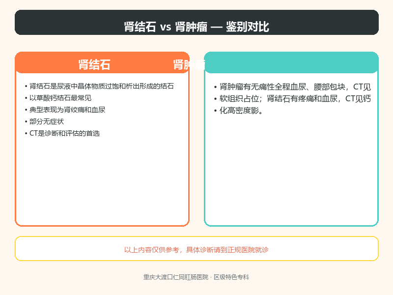 肾结石与肾肿瘤