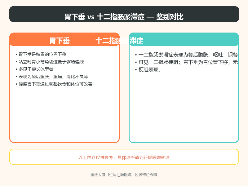 胃下垂与十二指肠淤滞症