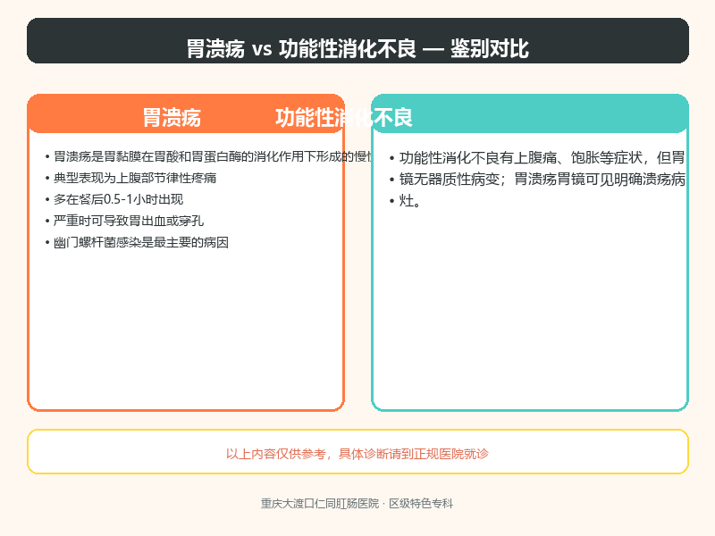 胃溃疡与功能性消化不良