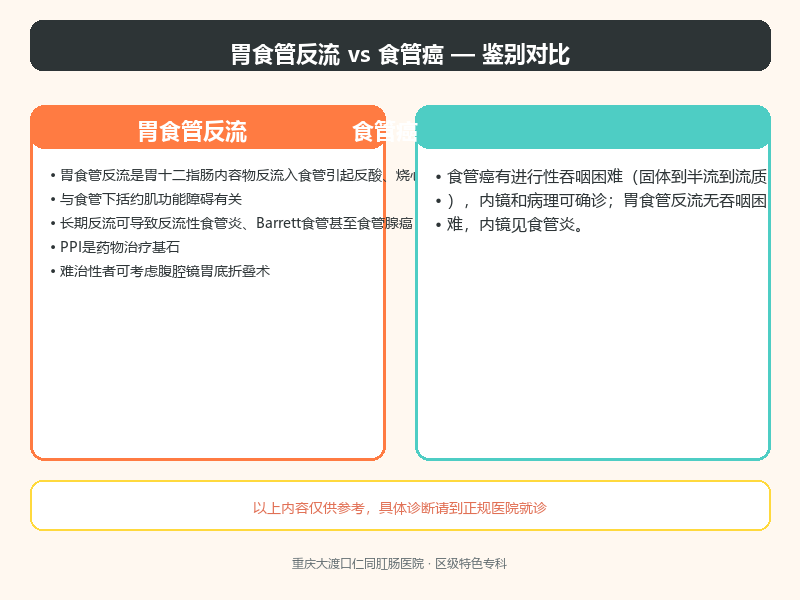 胃食管反流与食管癌