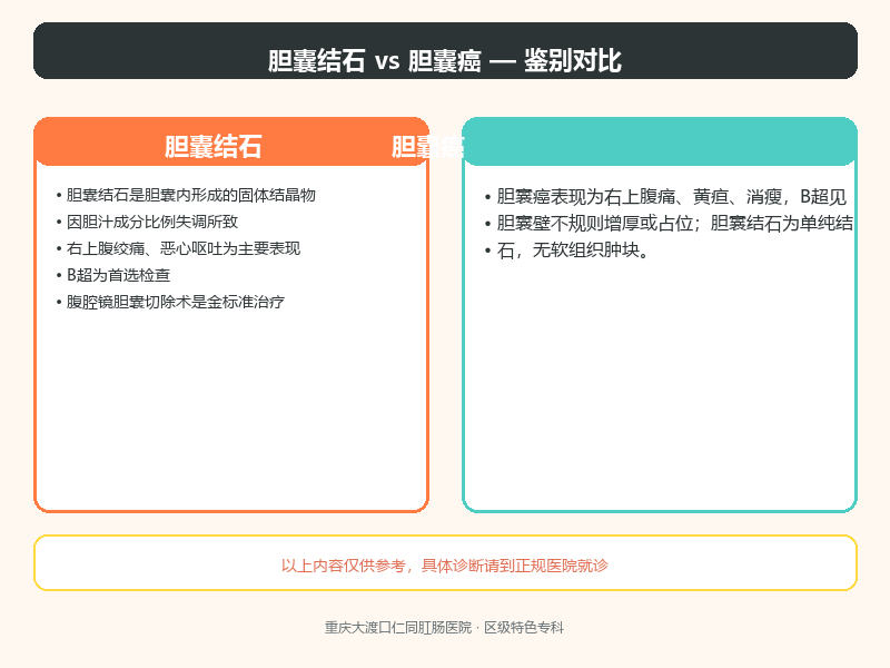 胆囊结石与胆囊癌的鉴别要点