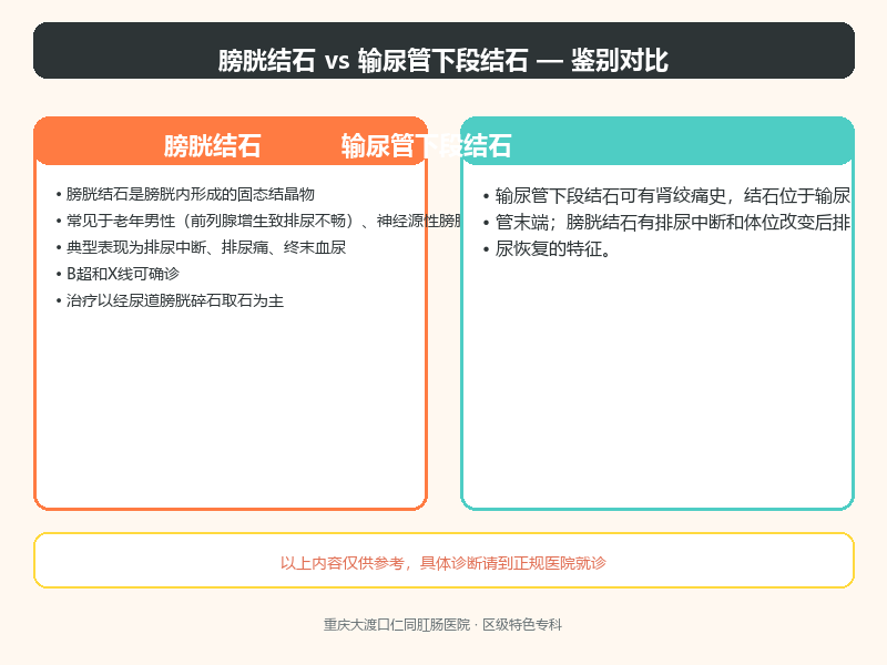 膀胱结石与输尿管下段结石