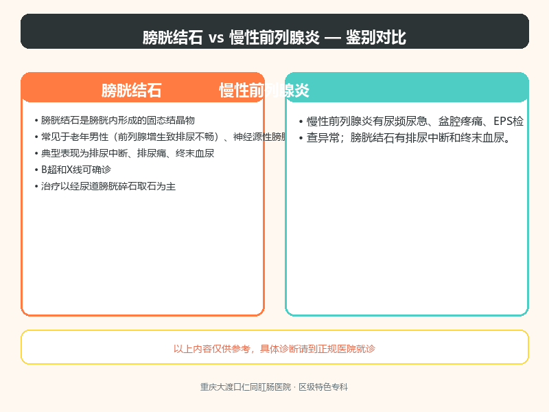 膀胱结石与慢性前列腺炎
