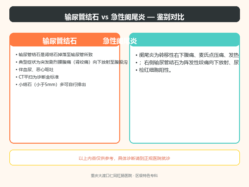 输尿管结石与急性阑尾炎
