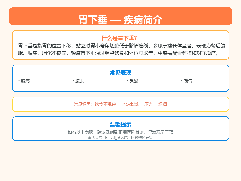 胃下垂科普示意图