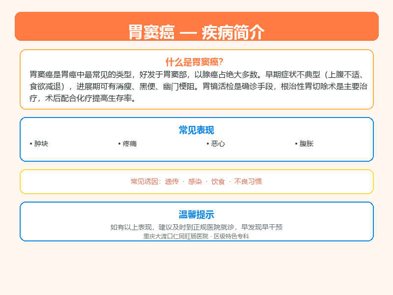 胃窦癌科普示意图