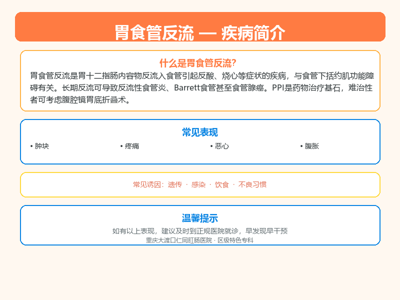 胃食管反流科普示意图