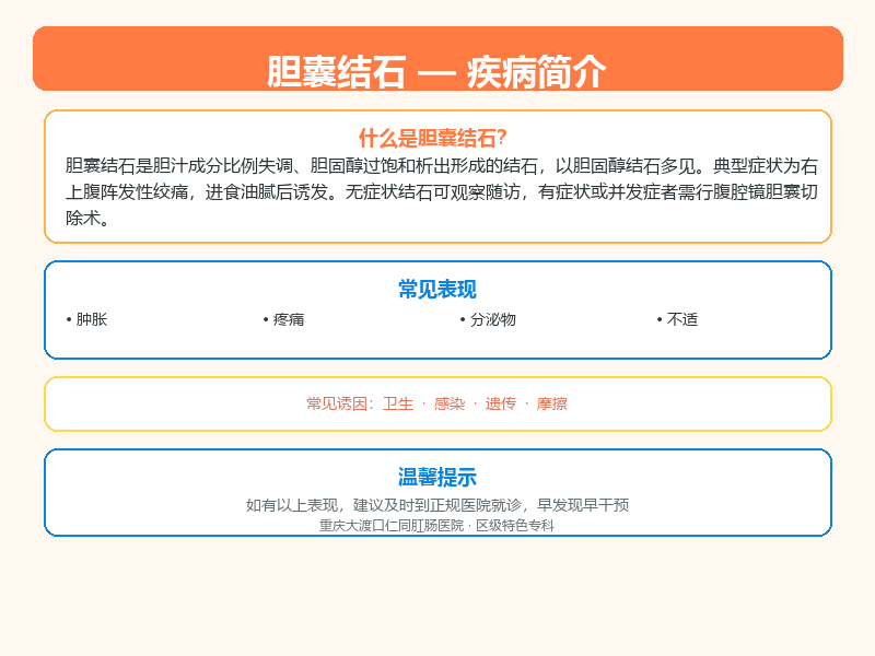 胆囊结石科普示意图