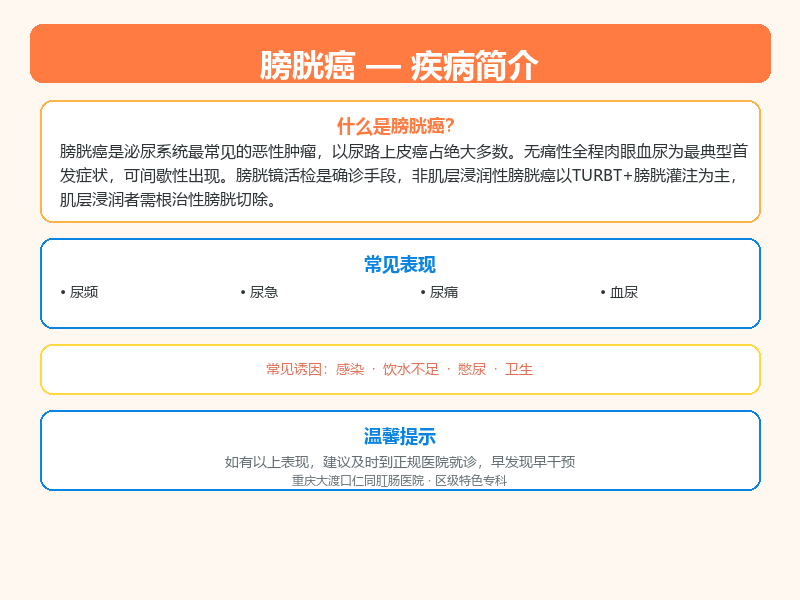 膀胱癌科普示意图