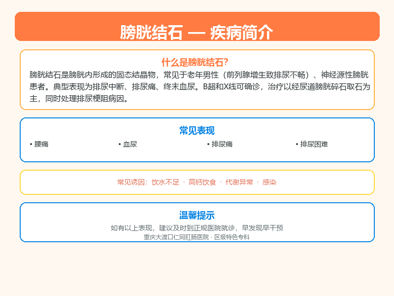 膀胱结石科普示意图