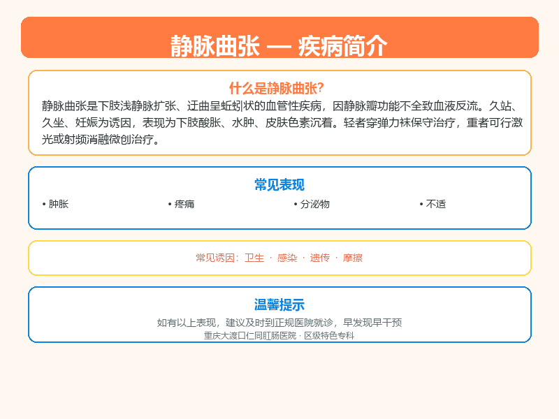 静脉曲张科普示意图