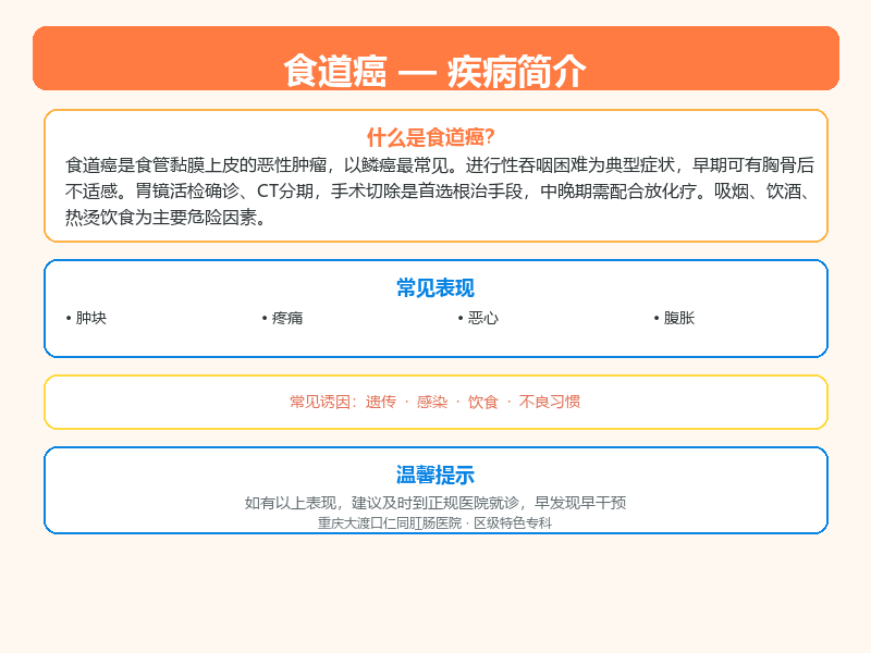 食道癌科普示意图