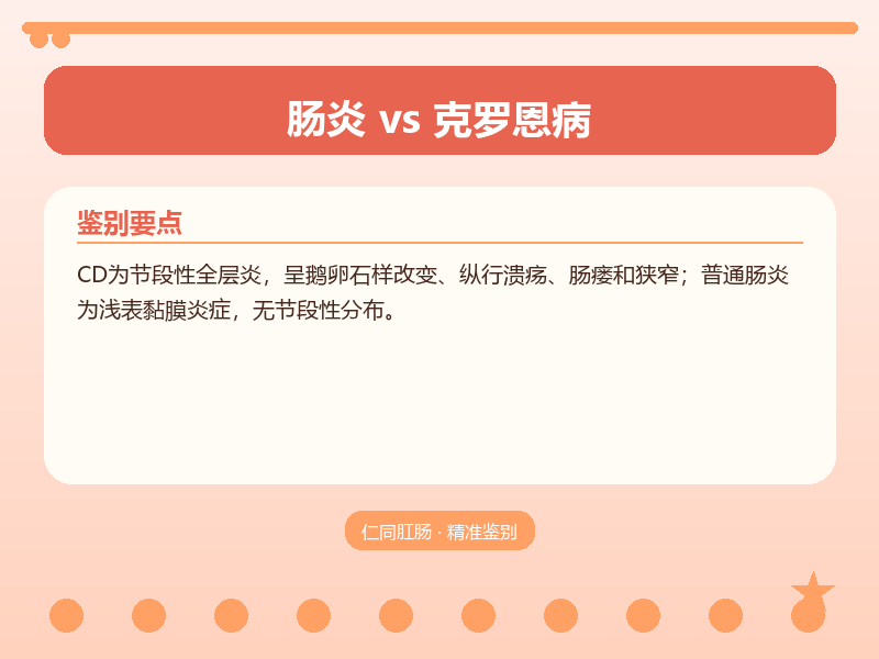 肠炎与克罗恩病的鉴别要点