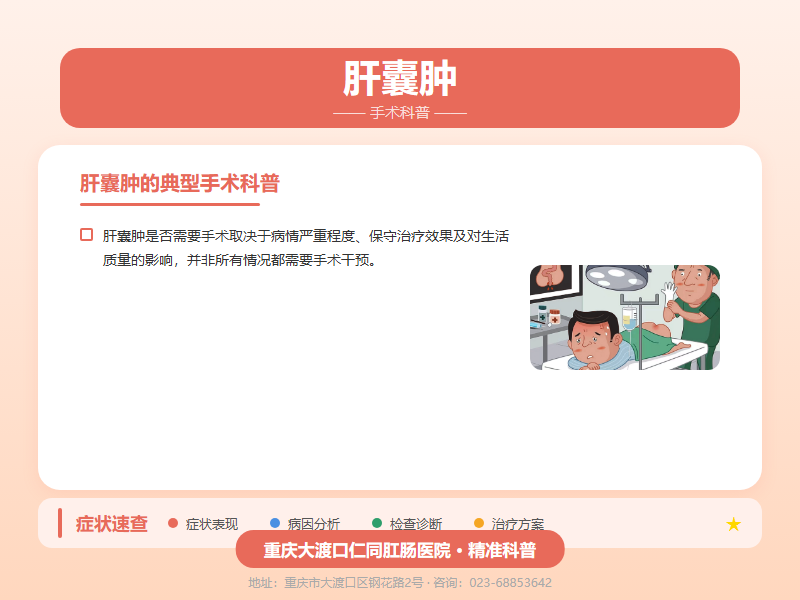 肝囊肿手术科普