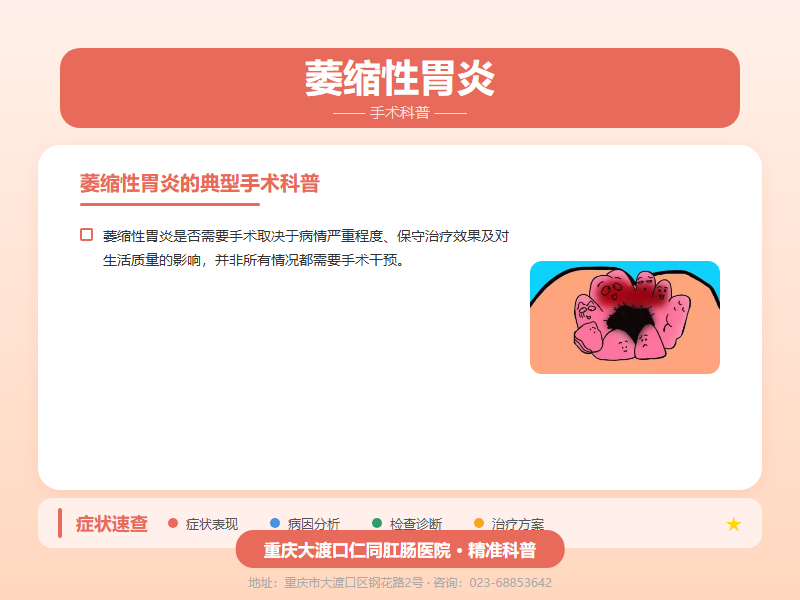 萎缩性胃炎手术科普