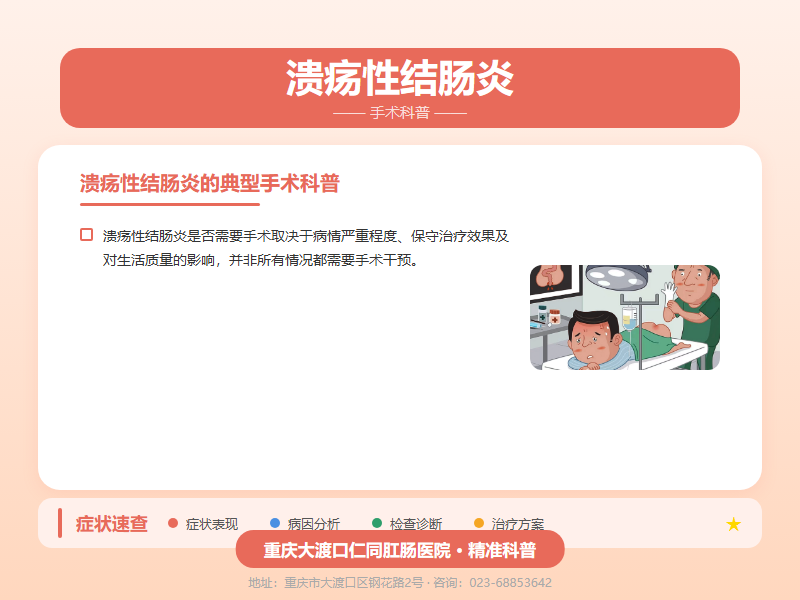 溃疡性结肠炎手术科普