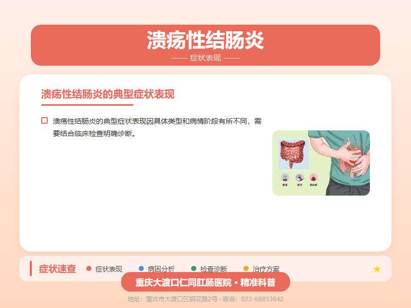 溃疡性结肠炎症状表现