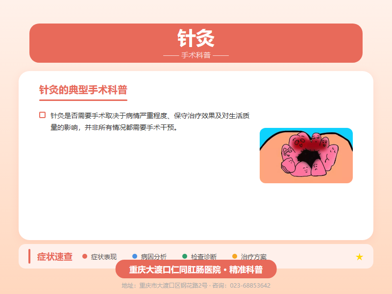 针灸手术科普