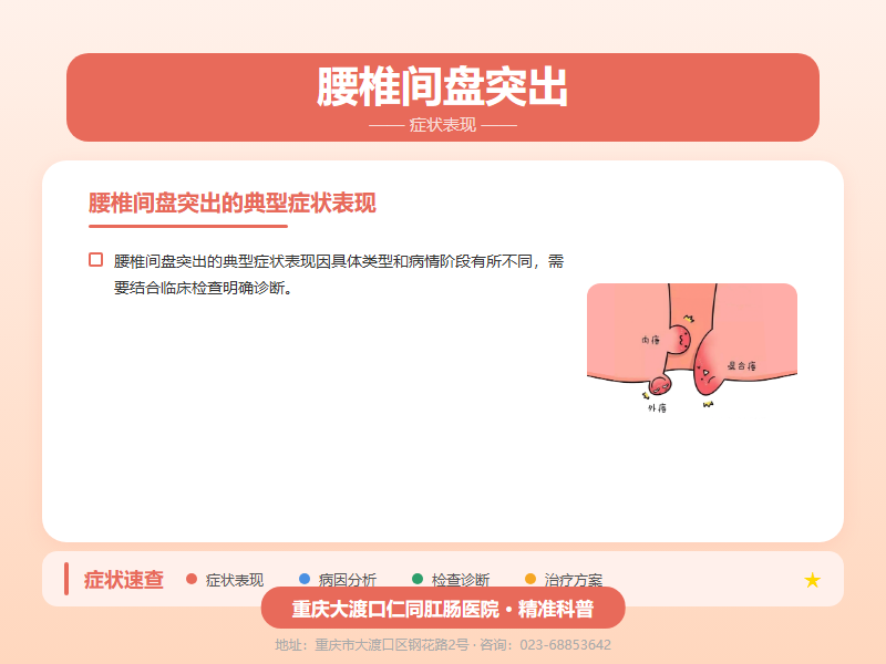 腰椎间盘突出症状表现