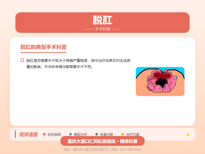 脱肛手术科普