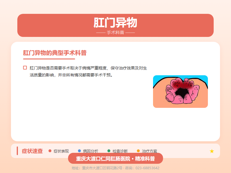 肛门异物手术科普