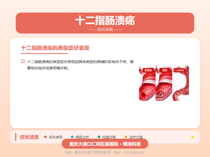 十二指肠溃疡症状表现