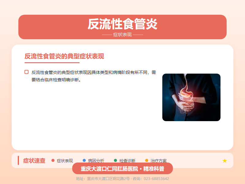 反流性食管炎症状表现