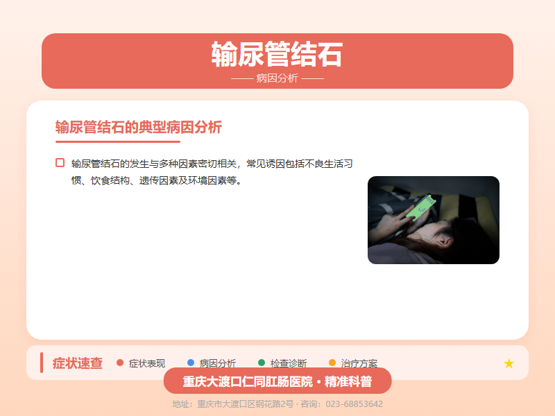 输尿管结石病因分析