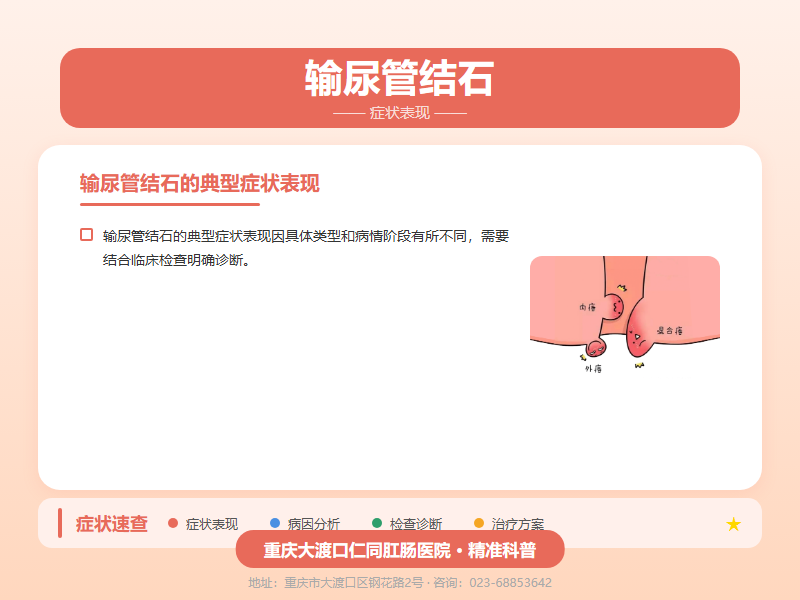 输尿管结石症状表现