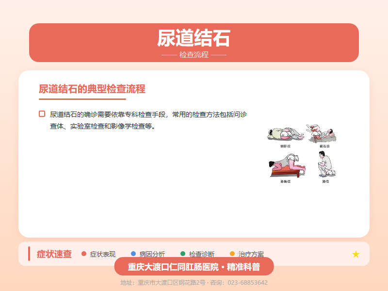 尿道结石检查流程