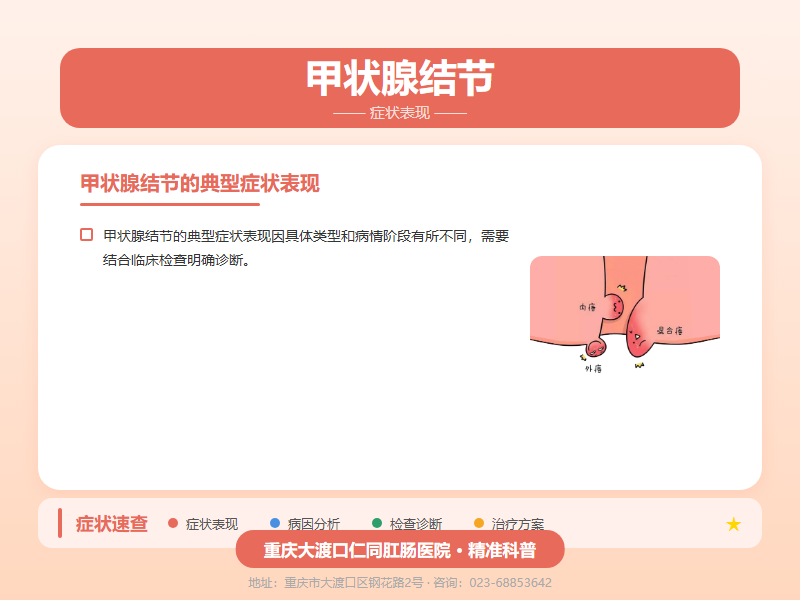 甲状腺结节症状表现