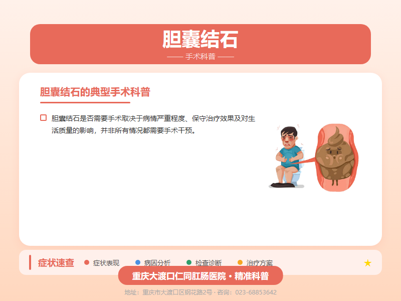 胆囊结石手术科普