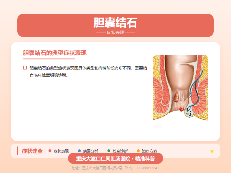 胆囊结石症状表现