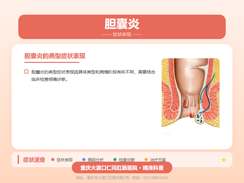 胆囊炎症状表现