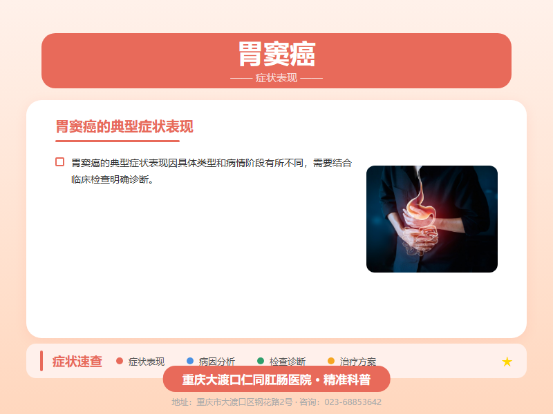 胃窦癌症状表现