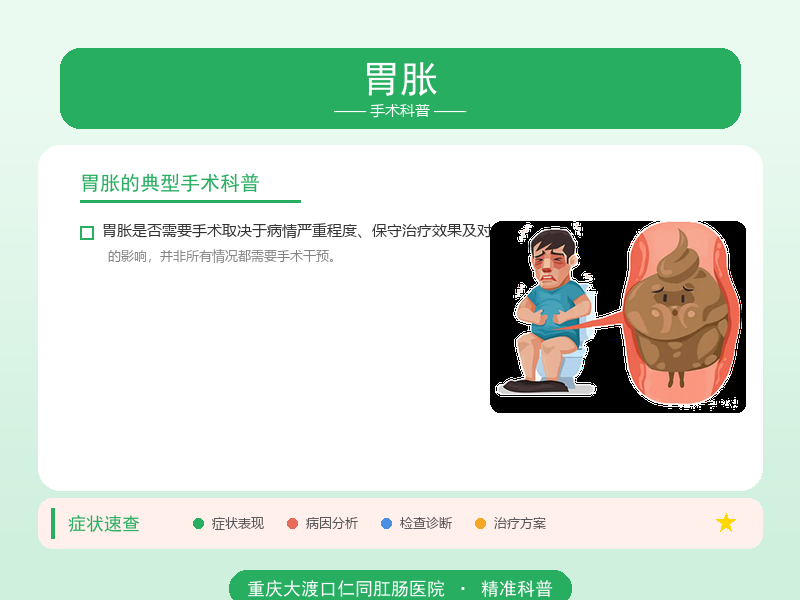 胃胀手术科普