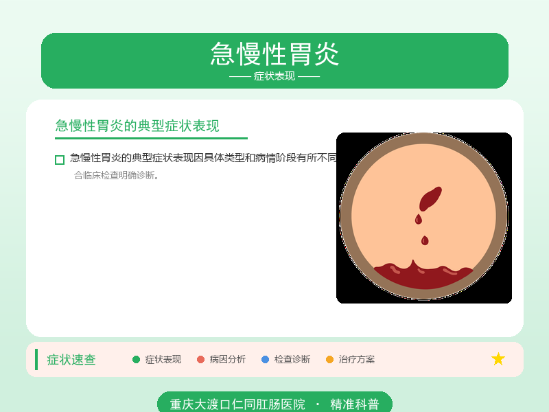 急慢性胃炎症状表现