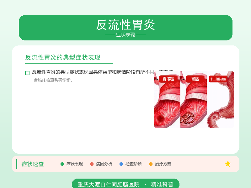 反流性胃炎症状表现