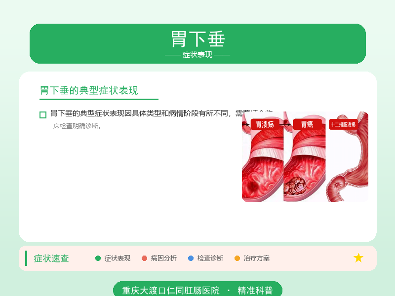 胃下垂症状表现